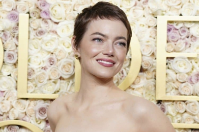 Emma Stone: Film için saçlarımı kazıtırken ağladım