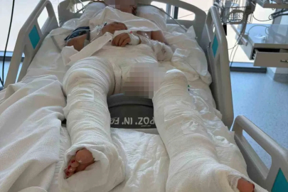 Genç kıza çarpıp üzerinden geçen sürücü tutuklandı
