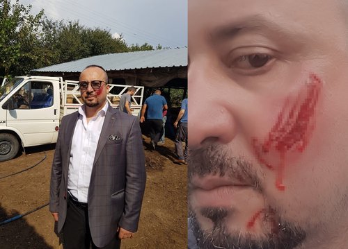Bursa’da haciz avukatına saldırıya hapis cezası