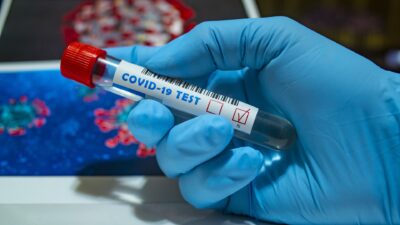27 Mayıs 2021 koronavirüs tablosu açıklandı: 183 can kaybı, 8 bin 426 yeni vaka