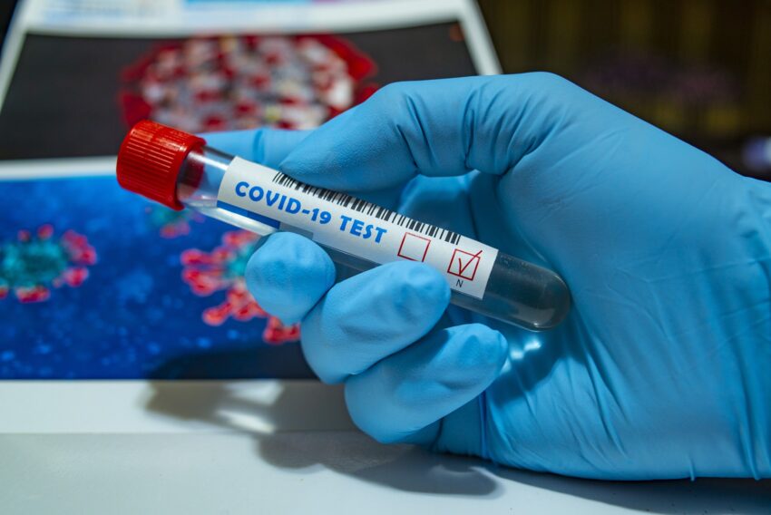 27 Mayıs 2021 koronavirüs tablosu açıklandı: 183 can kaybı, 8 bin 426 yeni vaka