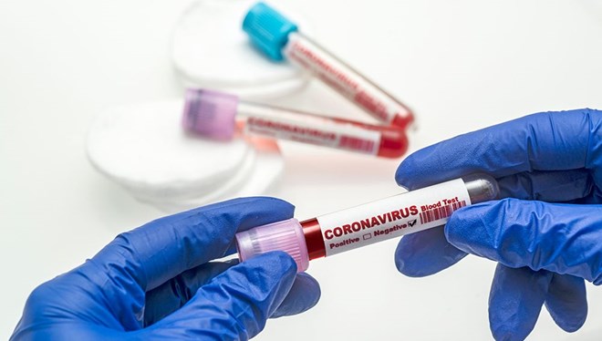17 Haziran koronavirüs tablosu açıklandı