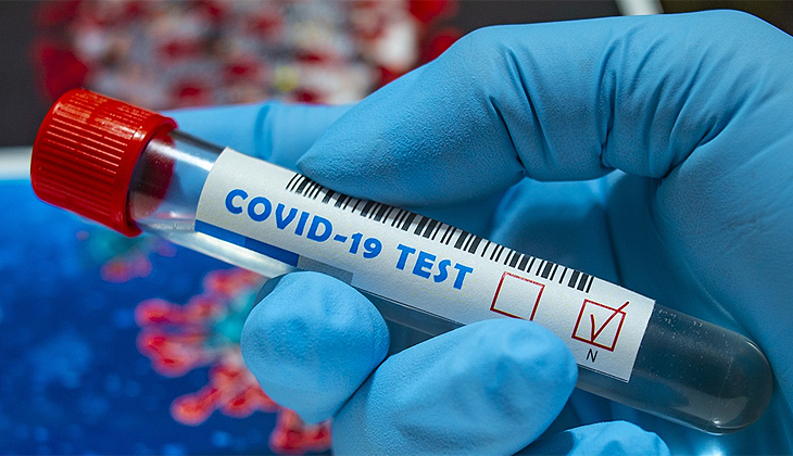 5 Eylül 2021 Günlük Koronavirüs Tablosu açıklandı