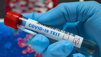 28 Aralık 2021 Koronavirüs Tablosu açıklandı