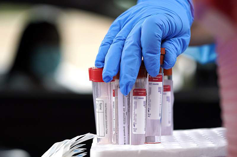 4 Kasım Koronavirüs Tablosu açıklandı! 29 bin 482 yeni vaka…