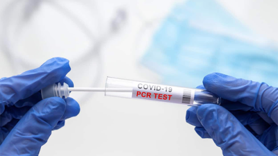24 Aralık 2021 Koronavirüs Tablosu açıklandı