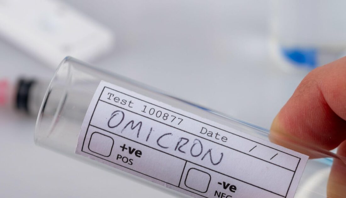 ‘Omicron kaynaklı ölümler, diğer varyantlara kıyasla yüzde 75 daha az’