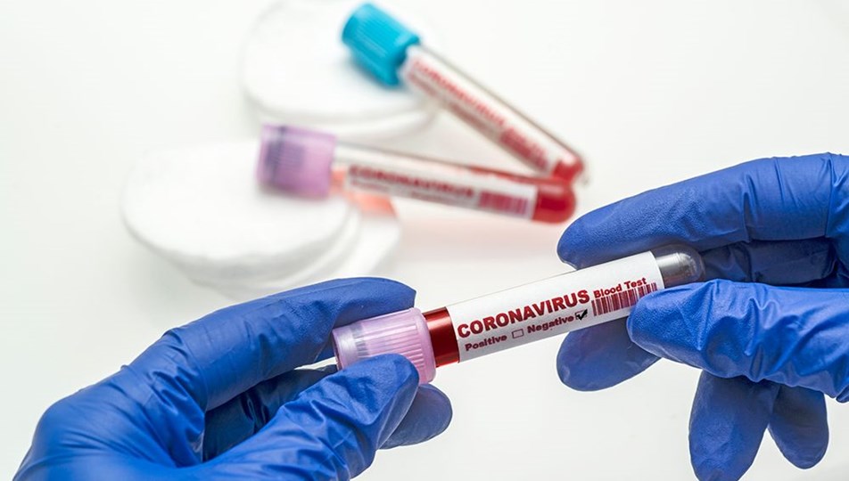 27 Kasım 2021 koronavirüs tablosu açıklandı