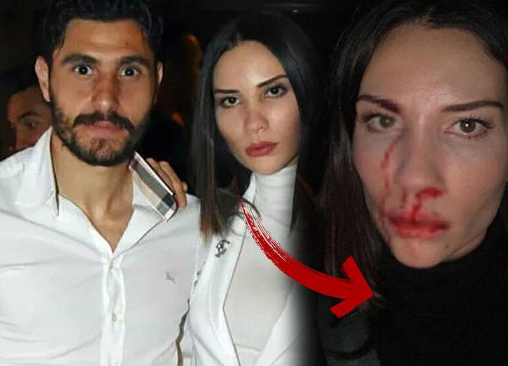 Mihriban Hurmacı’ya Özer Hurmacı’dan yalanlama!