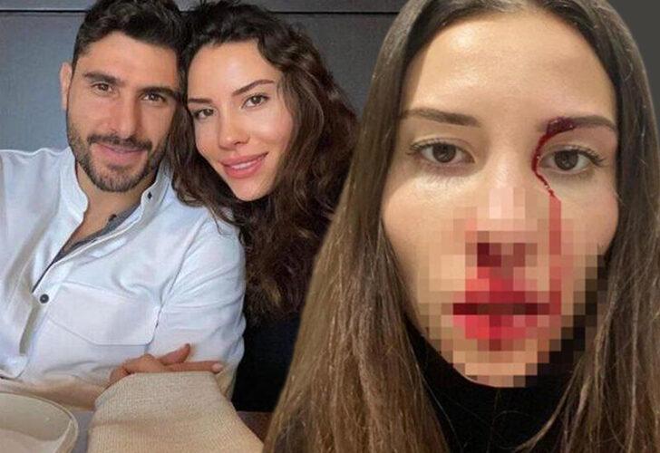 Eşi Mihriban Hurmacı’yı darp eden Özer Hurmacı hakkında flaş karar