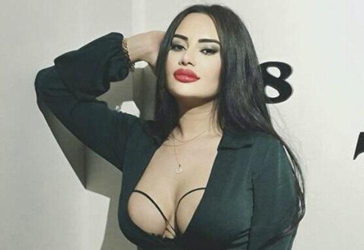 Eski gelin adayı Naz Mila kalça ameliyatı oldu!