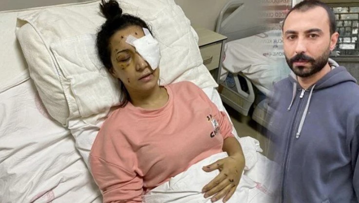 ‘Ağabey’ demeyen yengesini 37 yerinden bıçaklayıp kör etti
