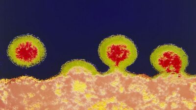 Kovid-19’dan sonra HIV virüsünün de yeni varyantı çıktı: Çok ölümcül ve hızlı yayılıyor