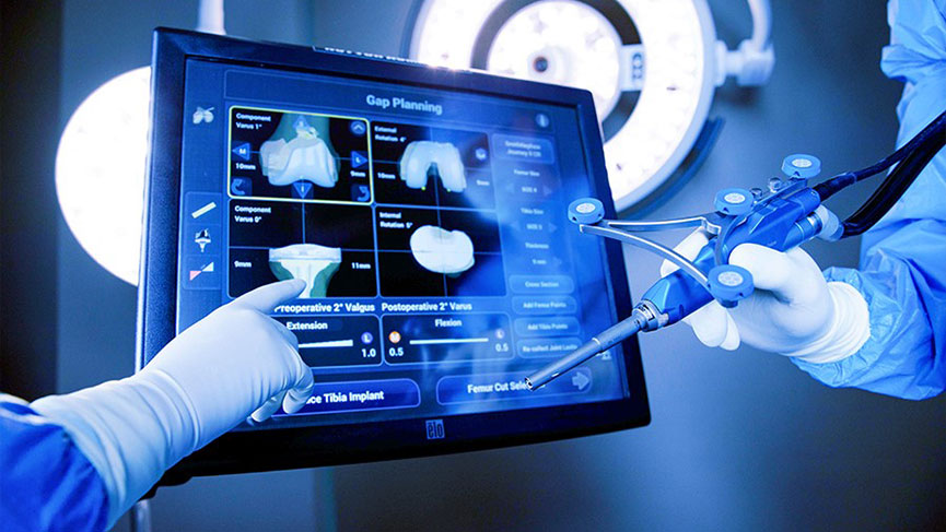 Robotik cerrahi teknolojisi ile kanamasız ameliyat mümkün