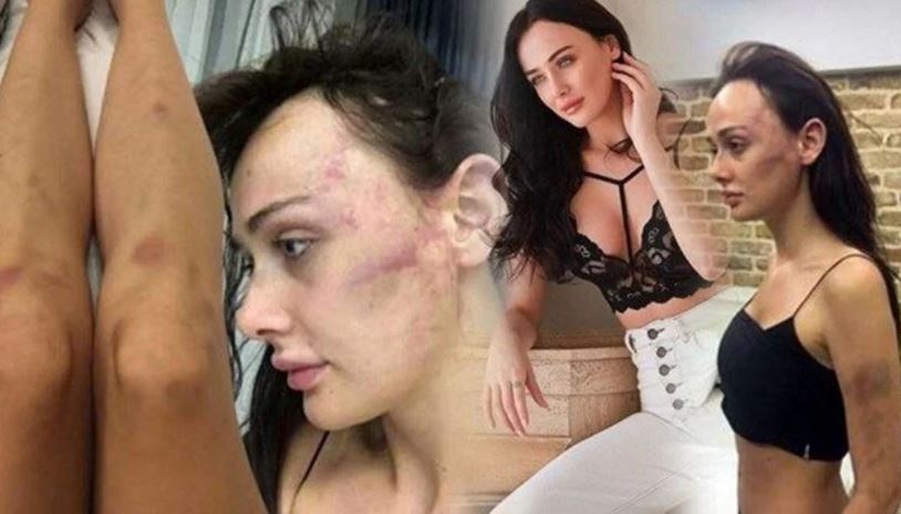 Sırp modelin yaralama davasında karar