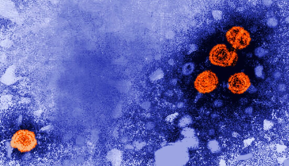Gizemli hepatit yeni bir küresel salgına neden olur mu?