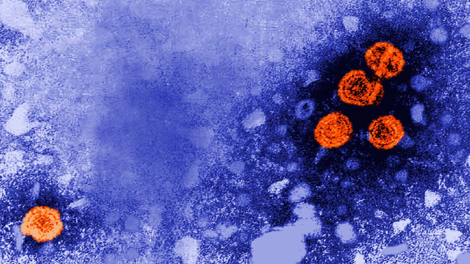 Gizemli hepatit yeni bir küresel salgına neden olur mu?
