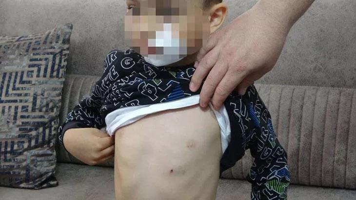 Anaokulu öğrencisi dehşeti yaşadı
