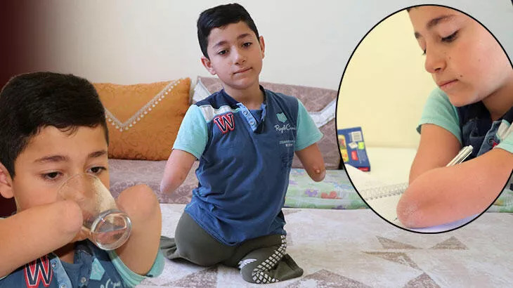 Kolları ve bacakları olmayan Nakşin, protez istiyor