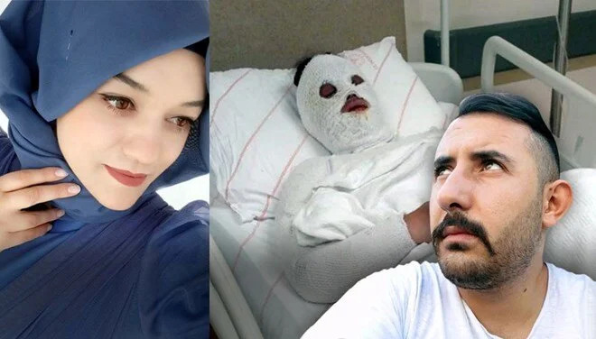 Eski nişanlıya kimyasal saldırı: İfadesi ortaya çıktı