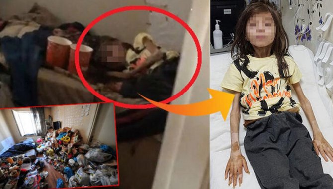 Bursa’da evde kilitli bulunan çocuk, Antalya AÜ Hastanesi’nde tedaviye alındı