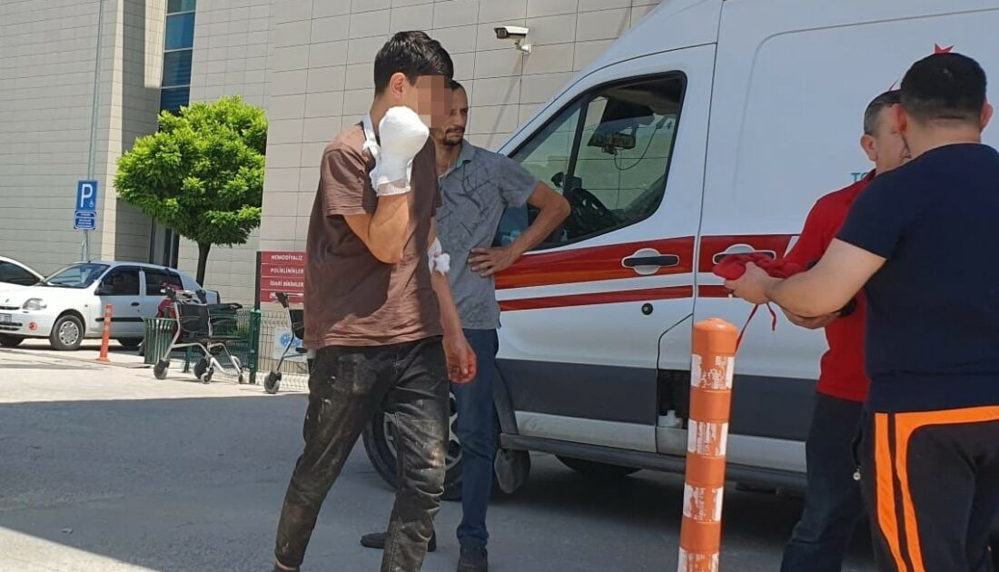 Bursa’da korkutan kaza! Elini kıyma makinesine kaptırdı