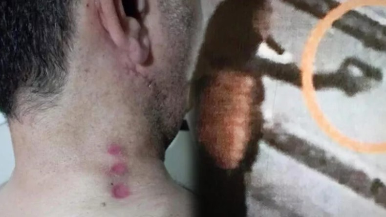 Takside ‘indi bindi’ dehşeti! Taksi ücreti tartışması kanlı bitti