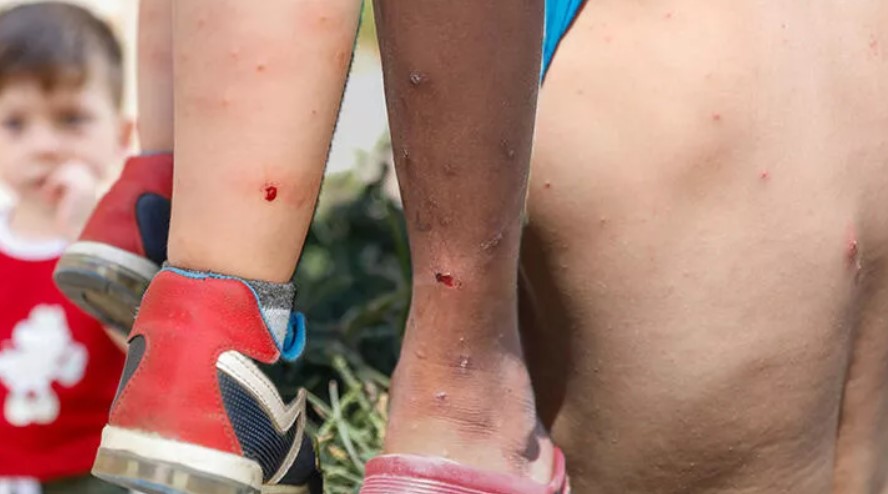 Yeni tehdit ‘Aedes’