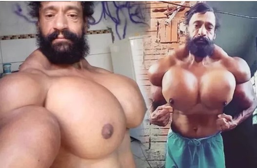 Doktorları dinlememişti! 55. yaş gününde öldü