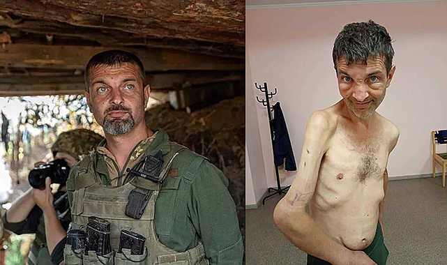 Ukraynalı askerin son hali dehşete düşürdü!