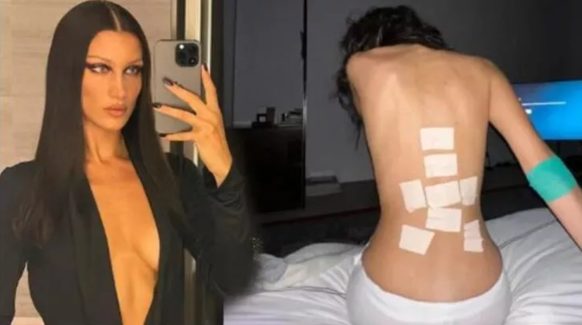 Bella Hadid hastanelik oldu!