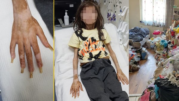 Türkiye Bursa’daki çöp evi konuşmuştu! Vicdansız teyze hakkında çarpıcı rapor
