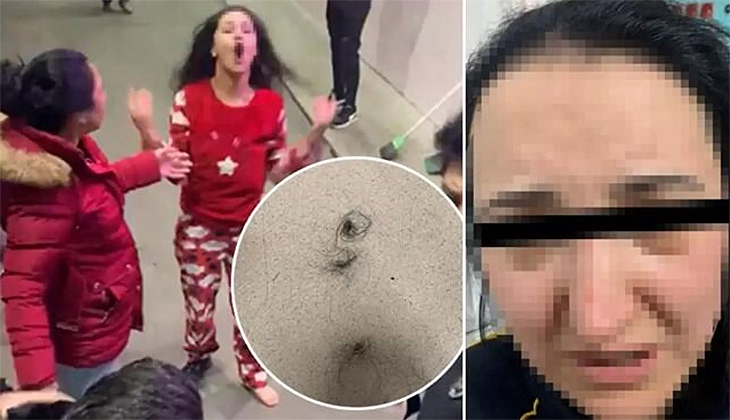 Darp raporu için gittiği hastanede hemşireye saldırdı