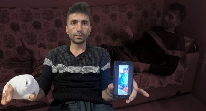 Köpek saldırısı: Parmağı koptu, eli parçalandı
