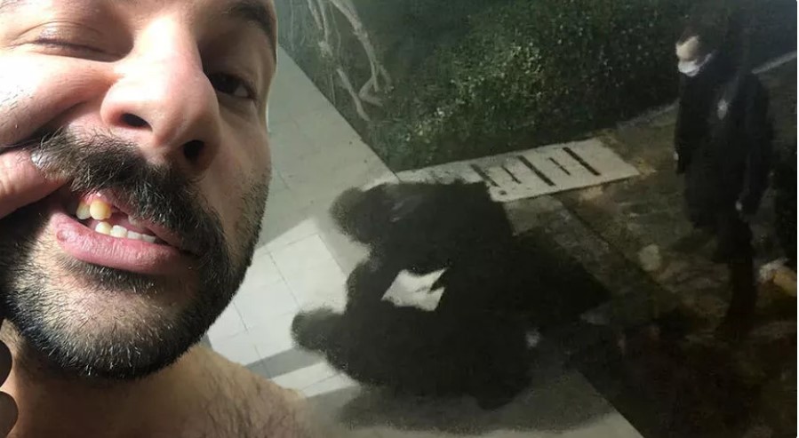 Dezenfektan molalı polis dayağında istenen ceza belli oldu