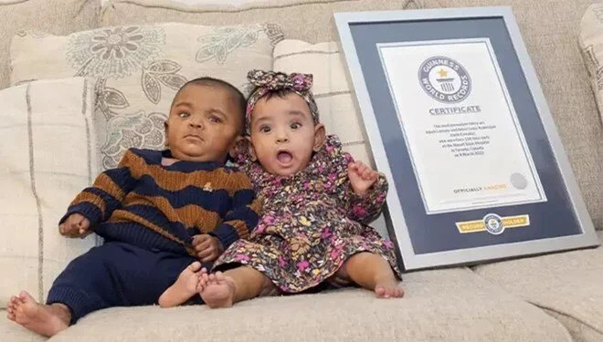 Kanadalı kardeşler Guinness Rekorlar Kitabı’na girdi: Dünyanın en erken doğan ikizleri