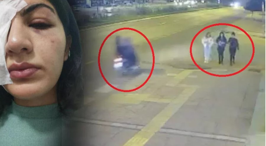 Su dolu balonla Hatice’yi gözünden yaralayan sanıklar tahliye edildi