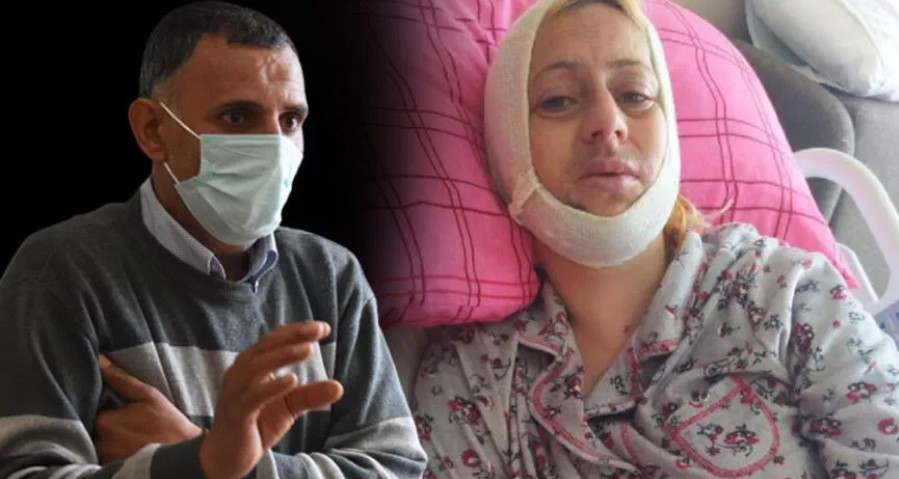 Hayvansever Aysun’un çenesini kıran sanığa hapis