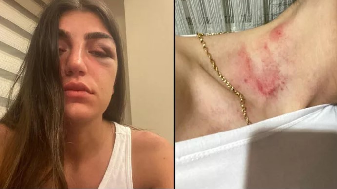 Manken Gizem Akbaş’ın darp edilmesine ilişkin davada sanığa 1 yıl hapis talebi