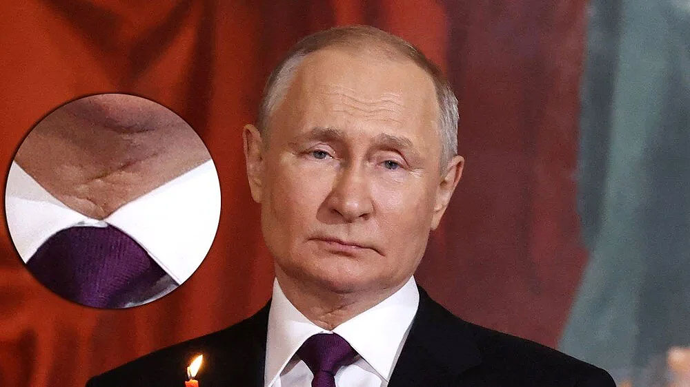 Putin kanser mi oldu? Boğazındaki iz dedikoduları tekrar alevlendirdi