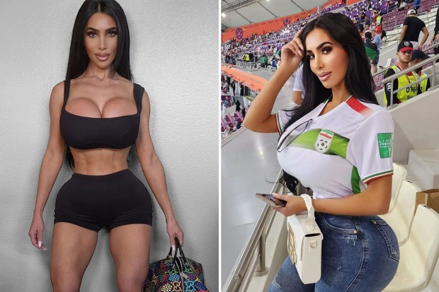 Kim Kardashian’a benzemek için defalarca ameliyat oldu: 34 yaşında hayatını kaybetti