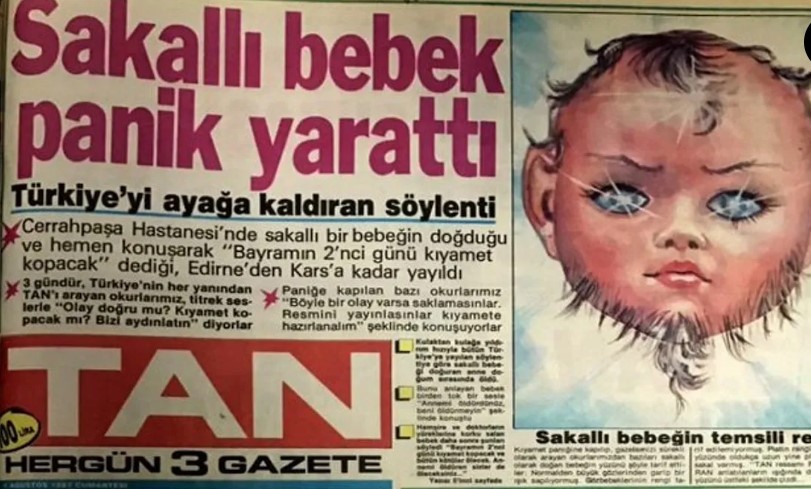 Türkiye’nin gündemini sarsmıştı! Sakallı bebek haberiyle ilgili bilinmeyenler