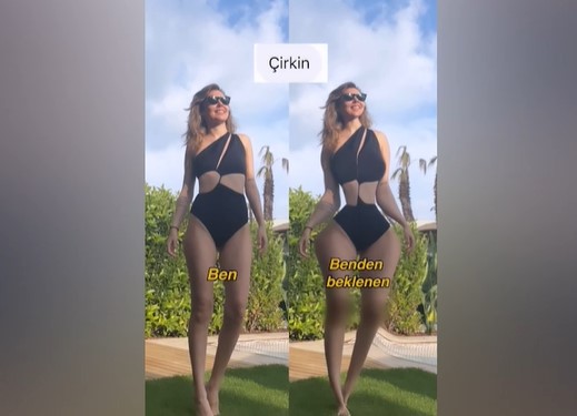Berfu Yenenler göğüslerini ve kalçasını büyütüp belini inceltti!