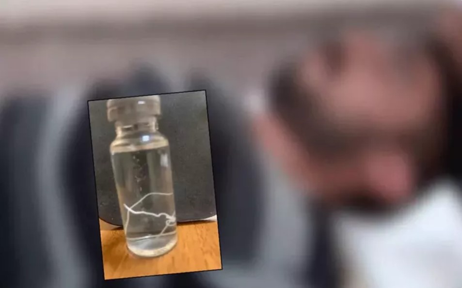 Başı ağrıyan hastanın alnından çıkanlara doktorlar bile şaştı kaldı!