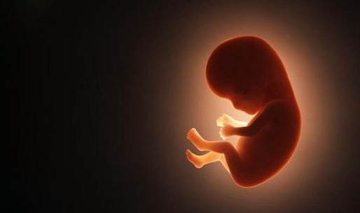 Karın ağrısıyla ortaya çıktı! Karnında 40 yıllık cenin bulundu