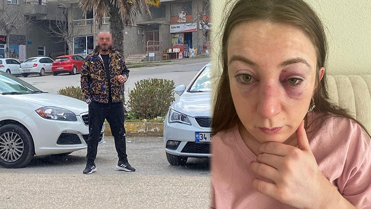 Bursa’da kadına şiddet: Ölmekten korkuyorum!