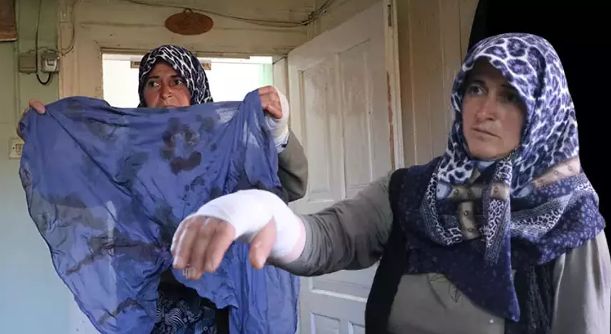 Sopayla dövüldü: Köyün kurallarına uymadıkları için bu hale geldi