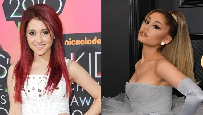 Ariana Grande: Birçok kez botoks yaptırdım