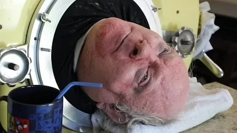 70 yıldır demir bir kapsülün içinde yaşıyor