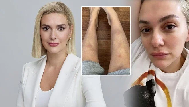 Bergüzar Korel: O morluklar, tokatlar filan hep rol değil mi?’